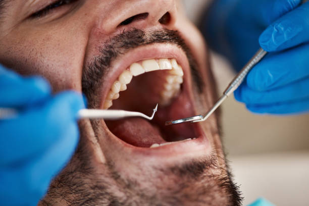 Best Emergency Dentist for Knocked-Out Tooth in Anna, TX