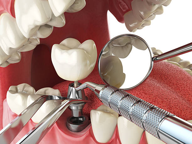Best Emergency Dental Services for Seniors in Anna, TX